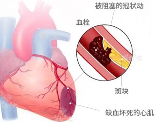 心臟病該怎么辦，且看臨床治療醫(yī)案一則